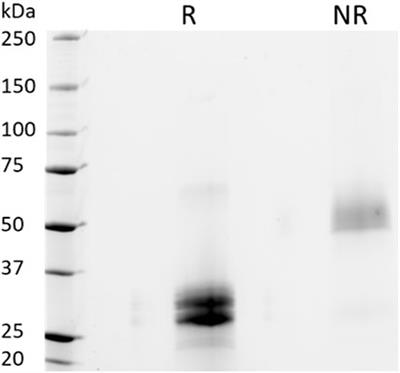 Plant-based production and characterization of a promising Fc-fusion protein against microgravity-induced bone density loss